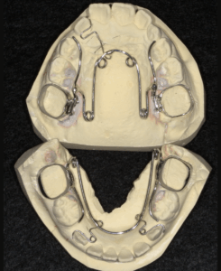 西端歯科医院 2×4 ワイヤー装置